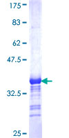 SDS-PAGE - Recombinant Human AHRR protein (AB153451), expandable thumbnail