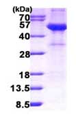 SDS-PAGE - Recombinant Human AHSG protein (His tag N-Terminus) (AB156750)