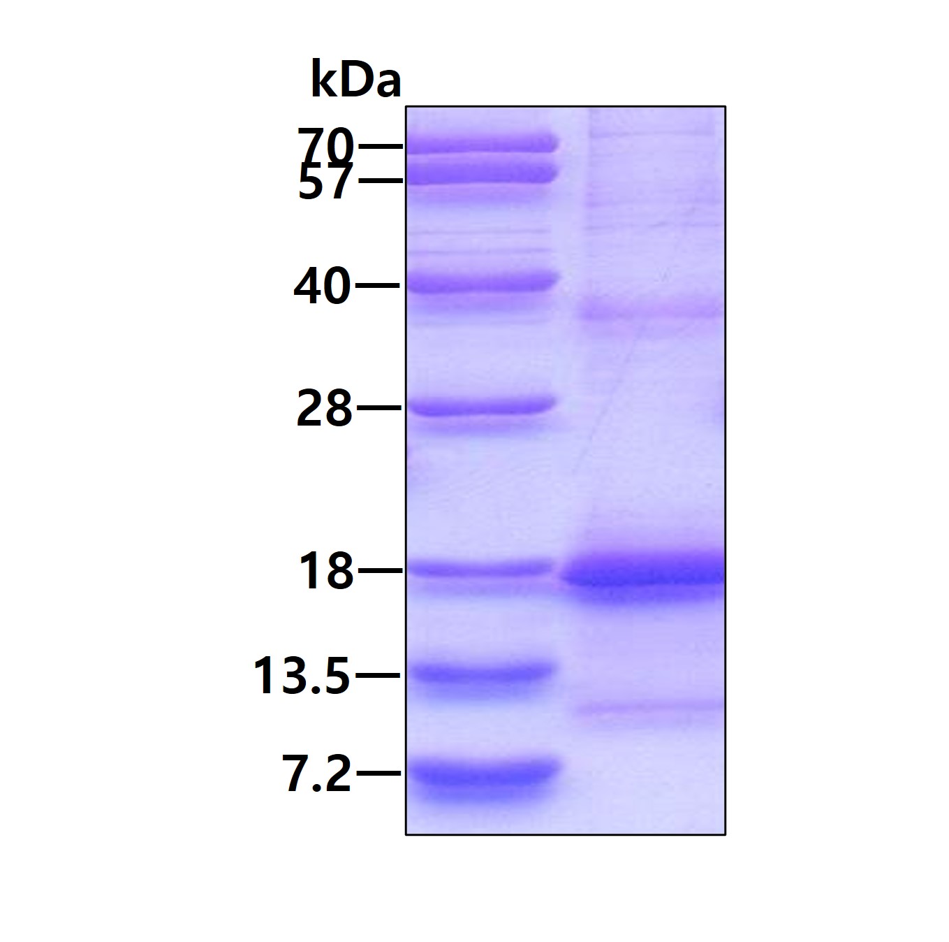 SDS-PAGE - Recombinant Human AICL protein (denatured) (AB139618)
