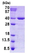 SDS-PAGE - Recombinant Human AIDA protein (AB140560)