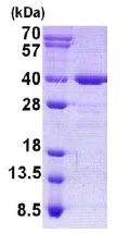 SDS-PAGE - Recombinant Human AIDA protein (His tag N-Terminus) (AB140560)
