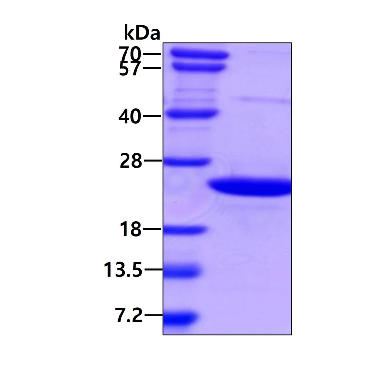 SDS-PAGE - Recombinant Human AIMP3/p18 protein (AB106904)