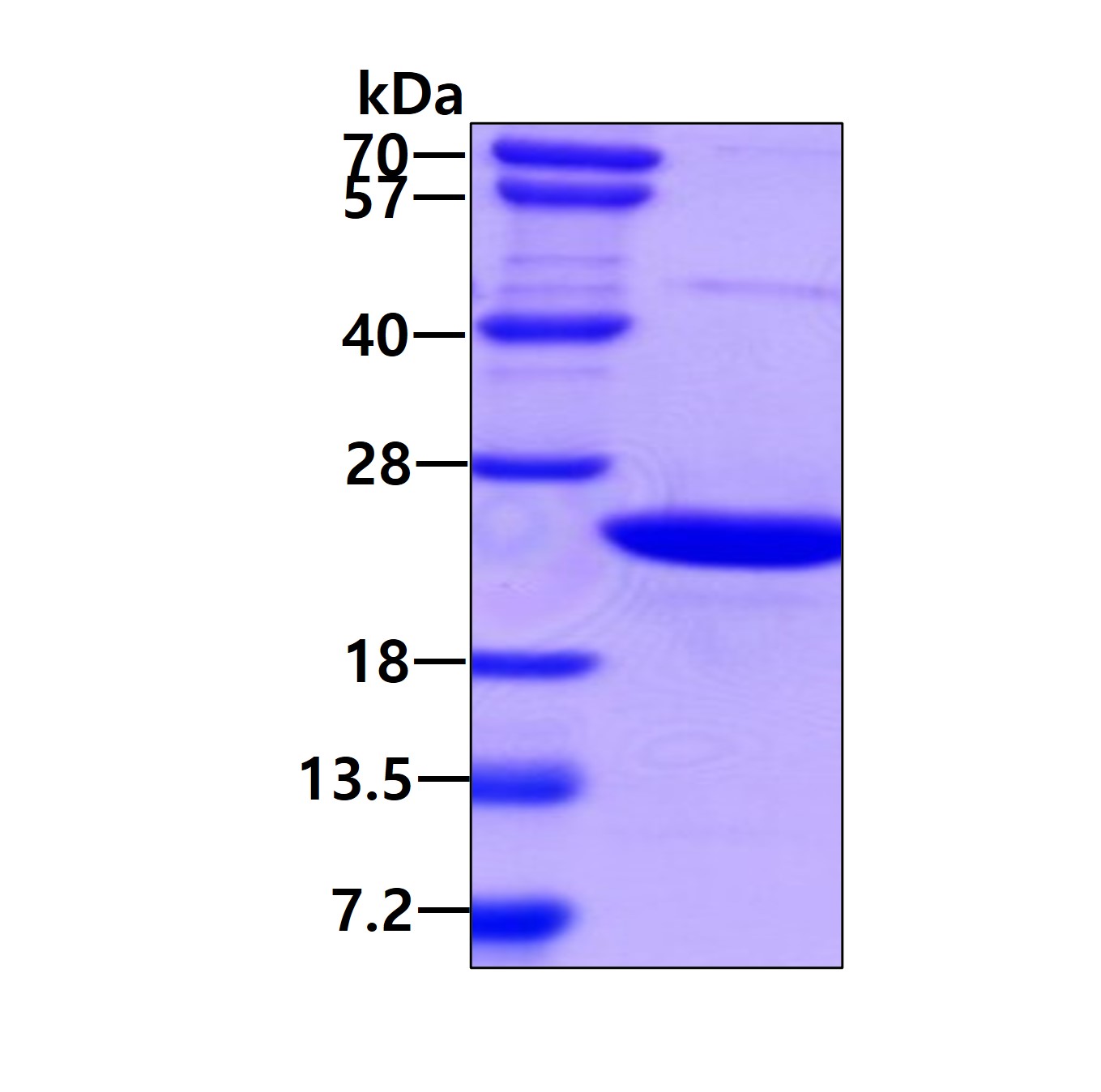 SDS-PAGE - Recombinant Human AIMP3/p18 protein (His tag N-Terminus) (AB106904)