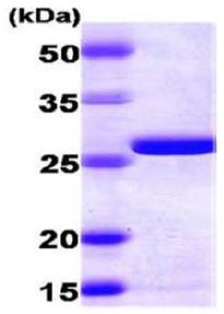 SDS-PAGE - Recombinant human AK2 protein (His tag N-Terminus) (AB167993)