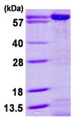SDS-PAGE - Recombinant Human AK5 protein (His tag N-Terminus) (AB113593)