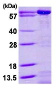 SDS-PAGE - Recombinant Human AK5 protein (His tag N-Terminus) (AB113593)