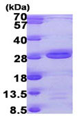 SDS-PAGE - Recombinant Human AK6 protein (His tag N-Terminus) (AB104633)