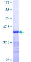 SDS-PAGE - Recombinant Human AKAP4 protein (GST tag N-Terminus) (AB152924)