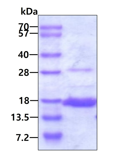 SDS-PAGE - Recombinant Human AKAP7 protein (AB126907)