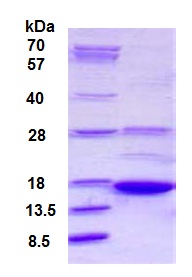 SDS-PAGE - Recombinant Human AKAP7 protein (AB126907)