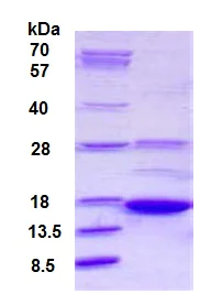 SDS-PAGE - Recombinant Human AKAP7 protein (His tag N-Terminus) (AB126907)