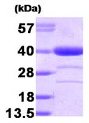 SDS-PAGE - Recombinant Human AKR1A1 protein (Tag Free) (AB95472)