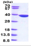 SDS-PAGE - Recombinant Human AKR1B10 protein (AB85415), expandable thumbnail