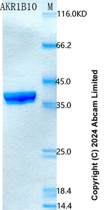 SDS-PAGE - Recombinant Human AKR1B10 Protein Standard (His tag) (AB322285), expandable thumbnail