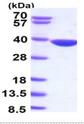 SDS-PAGE - Recombinant Human AKR1B10 protein (Tag Free) (AB85415)