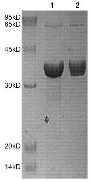SDS-PAGE - Recombinant Human AKR1C4 protein (AB172176), expandable thumbnail