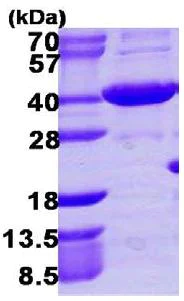 SDS-PAGE - Recombinant human AKR1C4 protein (His tag N-Terminus) (AB109831)