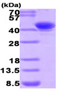 SDS-PAGE - Recombinant Human AKR7A2 protein (AB93634)