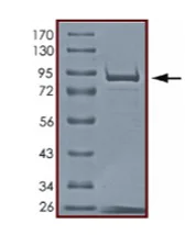 SDS-PAGE - Recombinant human AKT1 protein (AB205801)