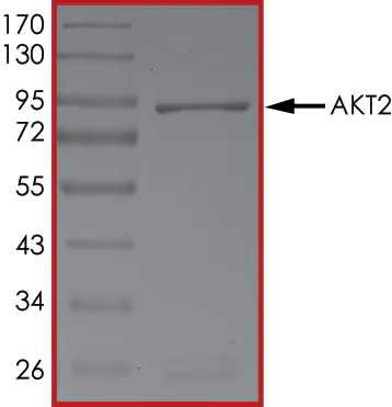 SDS-PAGE - Recombinant human AKT2 protein (AB60322)