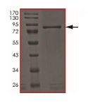 SDS-PAGE - Recombinant human AKT3 (mutated E17K) protein (AB186457), expandable thumbnail