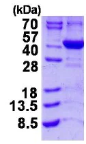 SDS-PAGE - Recombinant Human ALAD protein (His tag N-Terminus) (AB124318)