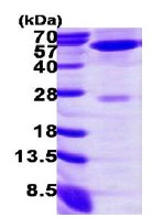 SDS-PAGE - Recombinant Human Alanine Transaminase protein (His tag N-Terminus) (AB113862)