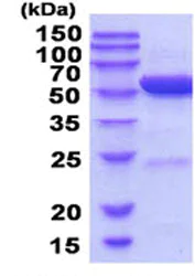 SDS-PAGE - Recombinant human Alanine Transaminase protein (His tag N-Terminus) (AB206804)