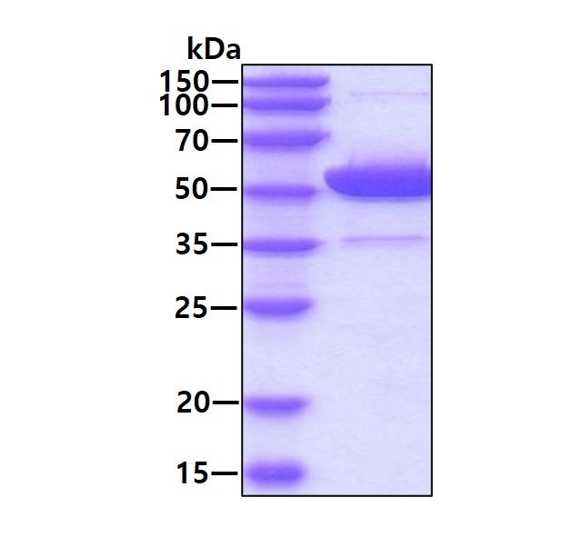 SDS-PAGE - Recombinant human ALDH2 protein (Active) (Tag Free) (AB87415)
