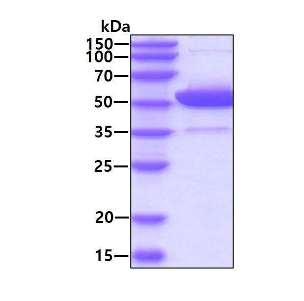SDS-PAGE - Recombinant human ALDH2 protein (Active) (Tag Free) (AB87415)