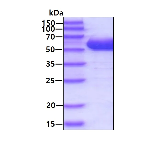 SDS-PAGE - Recombinant Human ALDH5A1/SSADH protein (His tag N-Terminus) (AB99429)