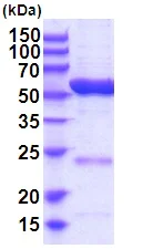 SDS-PAGE - Recombinant Human ALDH6A1 protein (AB201884)