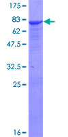 SDS-PAGE - Recombinant Human ALDH9A1 protein (AB157875)