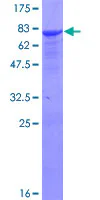 SDS-PAGE - Recombinant Human ALDH9A1 protein (GST tag N-Terminus) (AB157875)