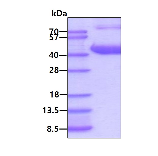 SDS-PAGE - Recombinant Human Aldolase B protein (His tag N-Terminus) (AB123165)