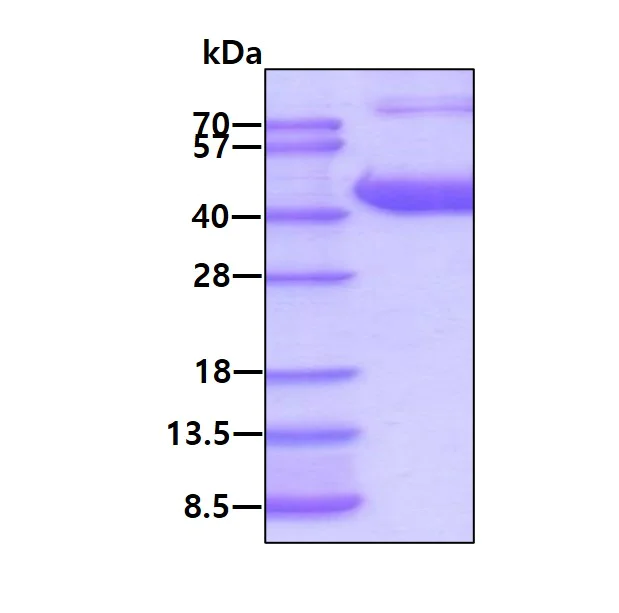 SDS-PAGE - Recombinant Human Aldolase B protein (His tag N-Terminus) (AB123165)