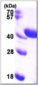 SDS-PAGE - Recombinant Human Aldolase C protein (AB105637), expandable thumbnail