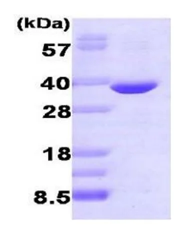 SDS-PAGE - Recombinant human Aldose reductase protein (Active) (AB275926)