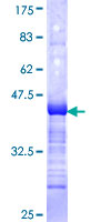 SDS-PAGE - Recombinant Human ALF protein (AB161255)