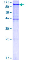 Recombinant Human ALIX protein