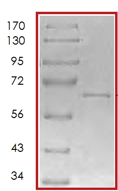 Recombinant human ALK-1 protein