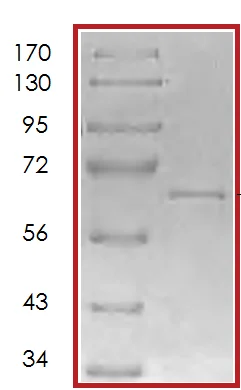 SDS-PAGE - Recombinant human ALK-1 protein (AB70317)