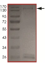 SDS-PAGE - Recombinant human ALK + EML4 protein (AB190998)