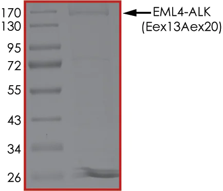 SDS-PAGE - Recombinant human ALK + EML4 protein (AB190998)