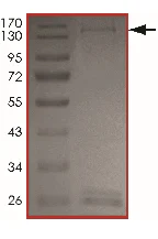 SDS-PAGE - Recombinant human ALK + EML4 protein (AB190998)