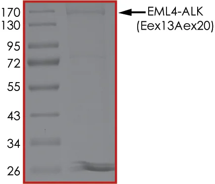 SDS-PAGE - Recombinant human ALK + EML4 protein (AB190998)