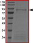 Recombinant human ALK (mutated F1174L) protein