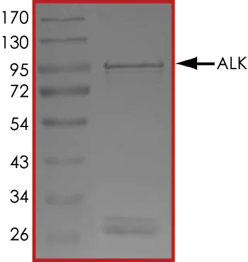 SDS-PAGE - Recombinant human ALK protein (Active) (AB187246)
