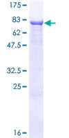 SDS-PAGE - Recombinant Human Alkaline Phosphatase protein (AB157880)