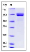 SDS-PAGE - Recombinant Human Alkaline phosphatase protein (His tag) (AB276514)